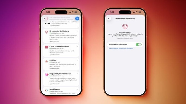 Tăng huyết áp iOS 26.2 beta 3