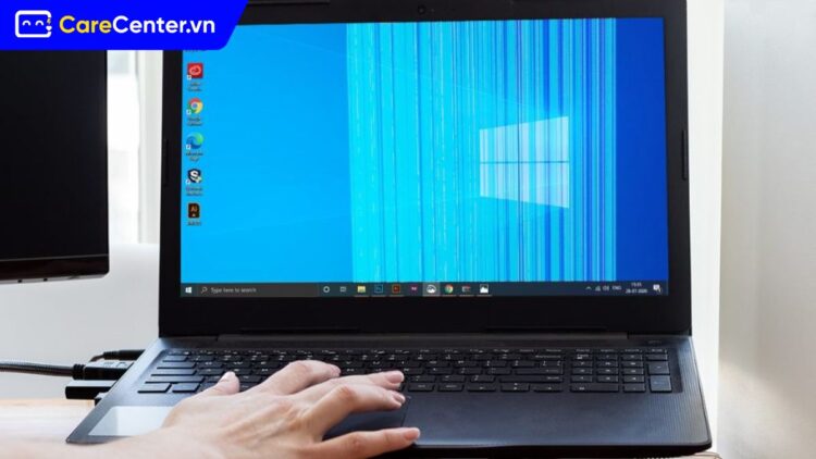 Màn hình laptop Dell bị sọc